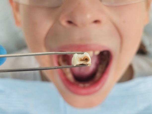 Best Weekend Emergency Dentist in Maquoketa, IA